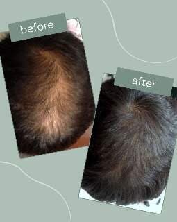 Transformation 1