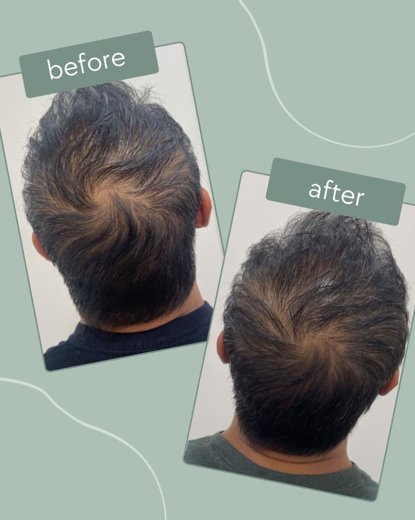 Transformation 4